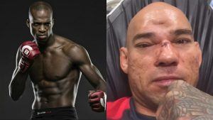 It's Been A Year Since 'Cyborg' Santos Forehead Caved In, Where is He?